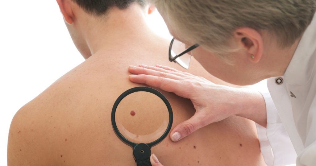 When was the last time you had your skin checked?